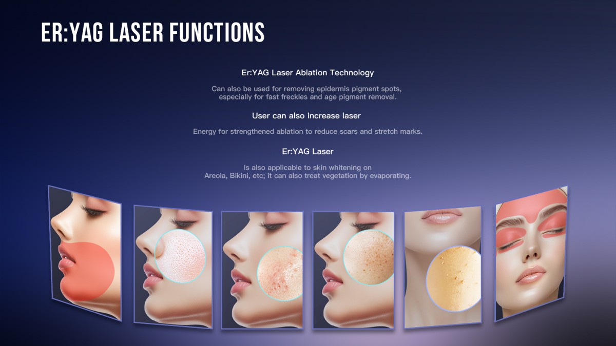 Clinical-Applications-of-the-2940nm-Erbium-YAG-Laser-Machine